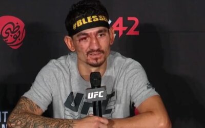 Max Holloway shows off leg injury days after UFC 300